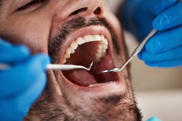 Best Same-Day Emergency Dental Services in Harper, KS